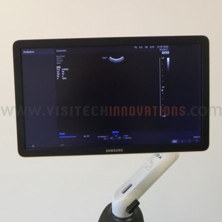 Samsung HS40 Ultrasound Systems (Used) - Sale!