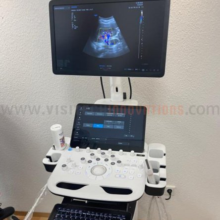 Samsung V5 Ultrasound Scanner (Used) - Sale!